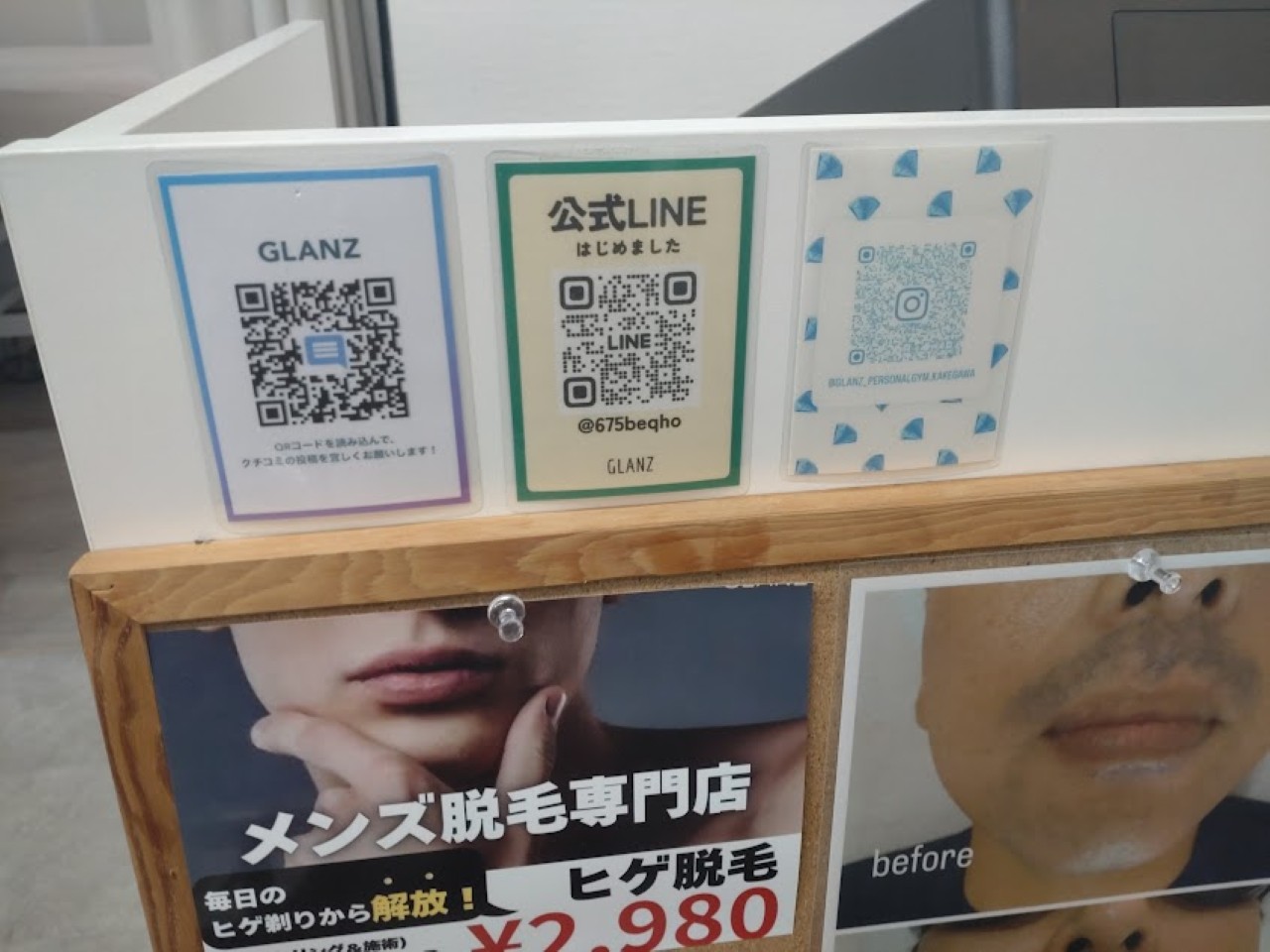 GLANZ掛川駅掛川市メンズ脱毛ひげ脱毛髭脱毛